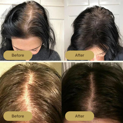 Biotic Vegans | Natural Hair Growth Oil