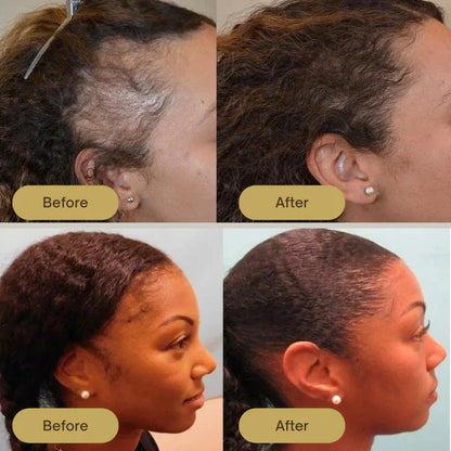 Biotic Vegans | Natural Hair Growth Oil